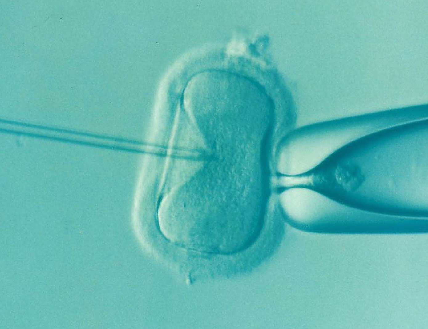 Un Bebe Presque Parfait La Vie Des Idees